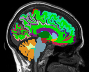 Brain imaging. Image provided by Dr. Sutton.